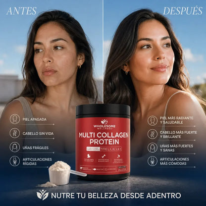 Multi Collagen Protein® | Colágeno para Piel, Cabello, Uñas y Articulaciones