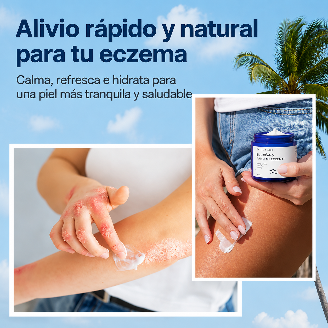 The Ocean Healed | Tratamiento Tópico Especializado para Piel Atópica. Fórmula Suave y Efectiva que Calma el Eczema y Restaura el Confort