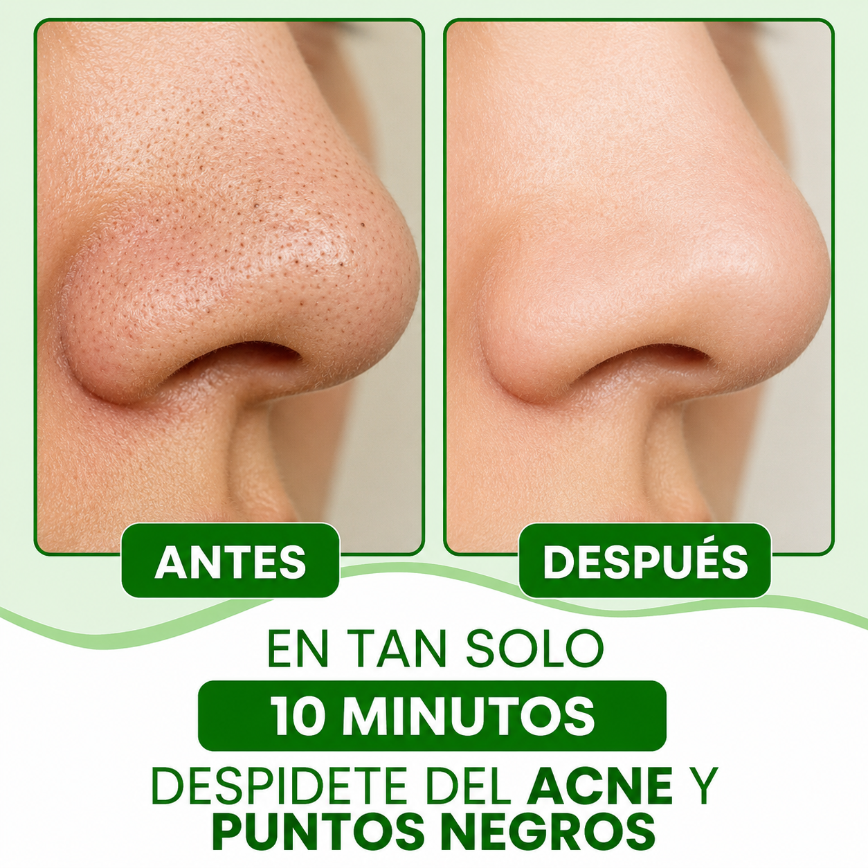 Lanbena®| Mascarilla Avanzada para Puntos Negros