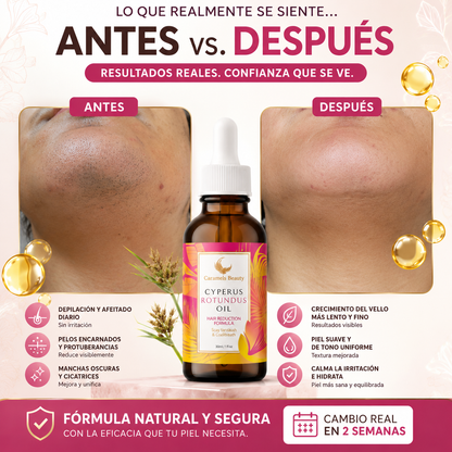 Cyperus Rotundus Oil (60 ml) | para la reducción natural del vello