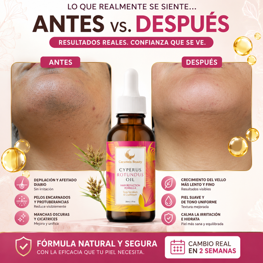 Cyperus Rotundus Oil (60 ml) | para la reducción natural del vello