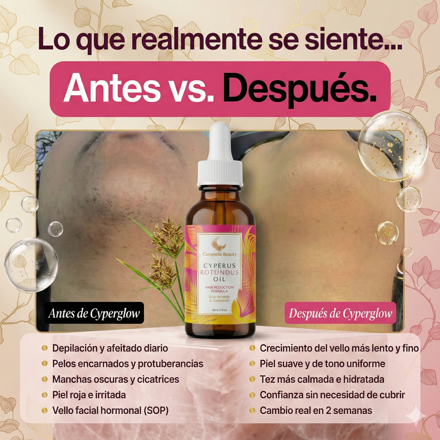 Cyperus Rotundus Oil | para la reducción natural del vello